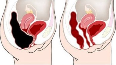 Photo of How to Remove Pounds of Toxic Waste from Your Colon – Recipe