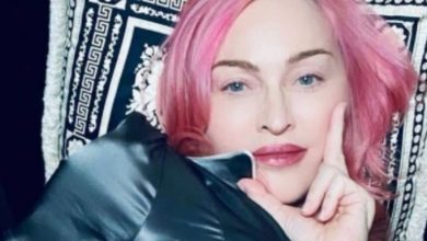 Photo of Madonna Shows Fans Her New Scar After Hip Injury