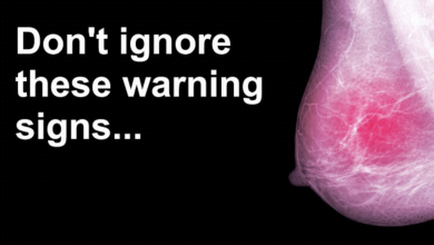 Photo of Women Must Stop Ignoring These 5 Signs of Breast Cancer
