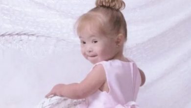 Photo of Doctors Wanted To Put Girl With Down Syndrome In An Institution, Look At Her Now As A Top Model