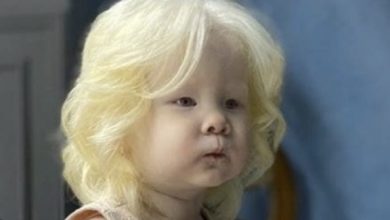 Photo of Albino sisters born 12 years apart amaze whole world with their extraordinary beauty