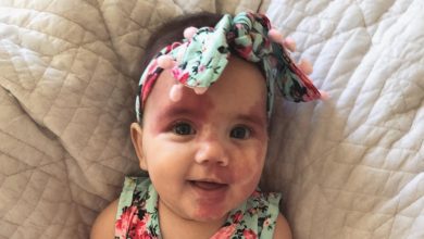 Photo of Mom paints face to look like daughter’s heart-shaped port wine birthmark
