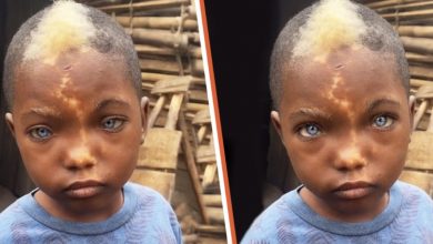 Photo of Youngster With Naturally Blue Eyes Snow-White Hair And Lightning-Shaped Birthmark On His Face Becomes An Internet Sensation