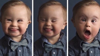 Photo of Agency refuses to let boy with Down syndrome model their clothes