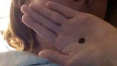 Photo of If You Ever Notice A Black Dot On Someone’s Palm, Call The Police Immediately