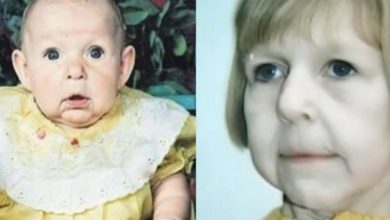 Photo of The Family Abandoned The Little Girl After Seeing Her Face. This is What Happened 22 Years Later
