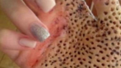 Photo of Is there a new type of lethal bug that punctures palms with numerous small holes?