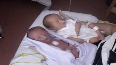 Photo of Couple expects identical twins — freeze when the doctor says “I’m sorry”