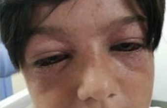 Photo of Mother’s Cautionary Tale For Parents After An 11-Year-Old Son’s Appearance Is Altered By a Playground Trend