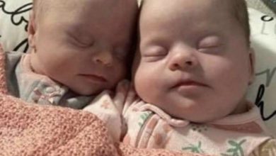 Photo of Florida woman gives birth to rare set of identical twins with Down syndrome – Look How Cute They Are…