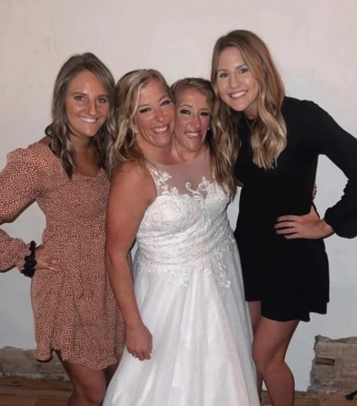 «One husband for two sisters! Siamese twins revealed their wedding ...