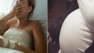 Photo of This woman’s pregnancy went normally, until an ultrasound showed her baby had malformations