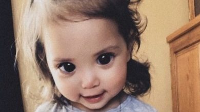 Photo of «Born with the biggest eyes!» This is what a girl born with huge eyes looks like years later