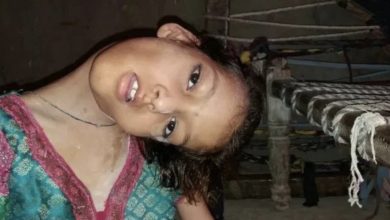 Photo of Despite having her head twisted to one side, the tough 9-year-old girl overcame her condition and made an effort to go through each day. vang