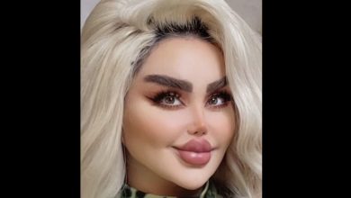 Photo of Woman Shows Off After Having 43 Surgeries To Look Like Barbie, Some Say She Looks Like A ‘Zombie’