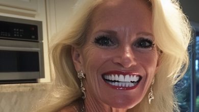 Photo of My stepmom took $5,000 from my college fund to pay for her veneers — but karma came back to bite her