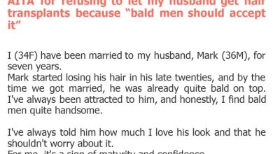 Photo of AITA for refusing to let my husband get hair transplants because “bald men should accept it”