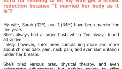 Photo of AITA for refusing to let my wife get a breast reduction because “I married her body as it is”?