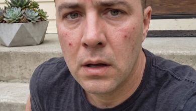 Photo of My Husband Nearly Died in a Wasp Attack — Then My 5-Year-Old Daughter Told Me, “Another Mommy Kisses Daddy When You’re at Work”